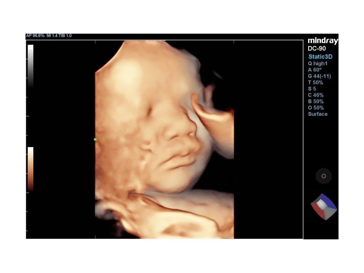 Smart Face / 4D визуализация
