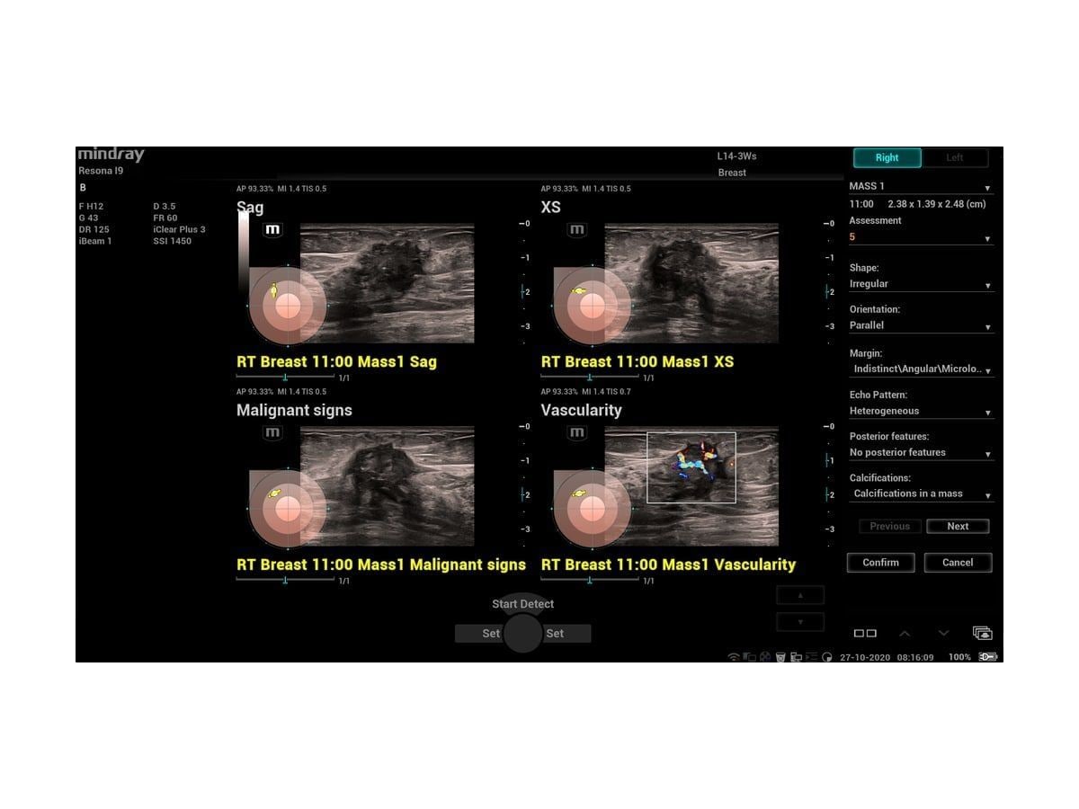 Smart Breast / Smart Thyroid